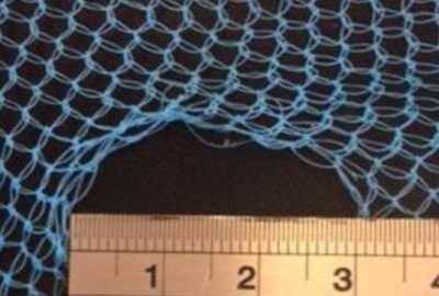 Image of blue netting against a black background with a hole in the bottom centre of the net fabric. A silver ruler at the bottom of the image is laid across the diameter of the hole, showing the hole is 3 cm wide.